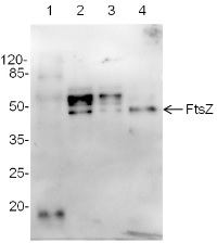 FtsZ | Procaryotic cell division GTPase (cyanobacterial) in the group Antibodies Plant/Algal / Developmental Biology / Cytoskeleton at Agrisera AB (Antibodies for research) (AS07 217)